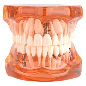 Diş Hekimi Okulu için Dental Model Çıkarılabilir Göst